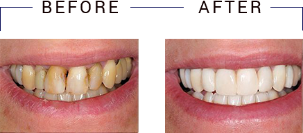 Yu Smile Dental | Emergency Treatment, Veneers and Preventative Program